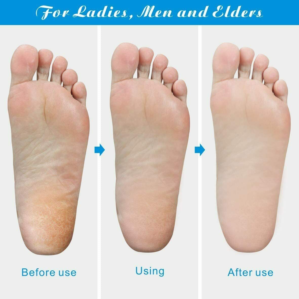 Professional Foot Callus Remover File Rasp Scraper Cracked Pedicure Rough Tool